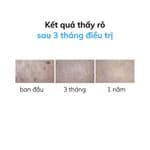 Kem Chống Nắng Ngừa Ung Thư Isdin Eryfotona AK-NMSC SPF 100+ Fluid
