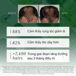 Tinh Chất Mọc Tóc Rene Furterer Triphasic Progressive
